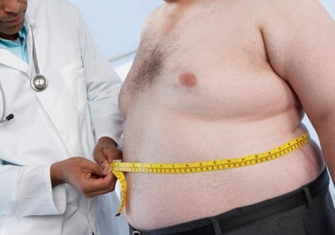 Cirurgia Bariátrica