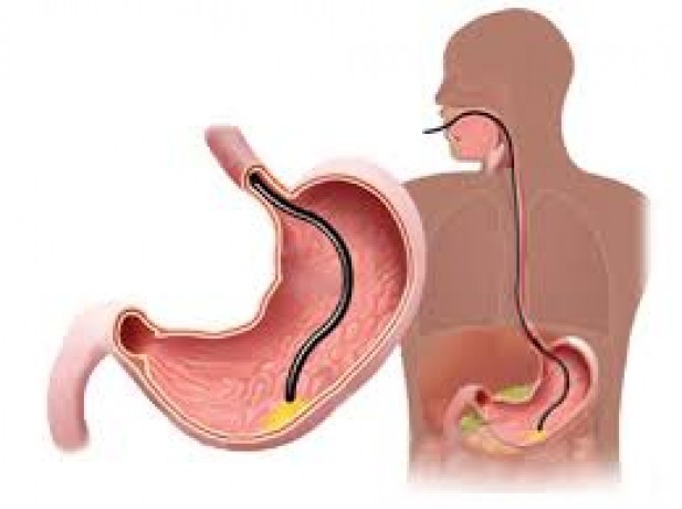Endoscopia Digestiva