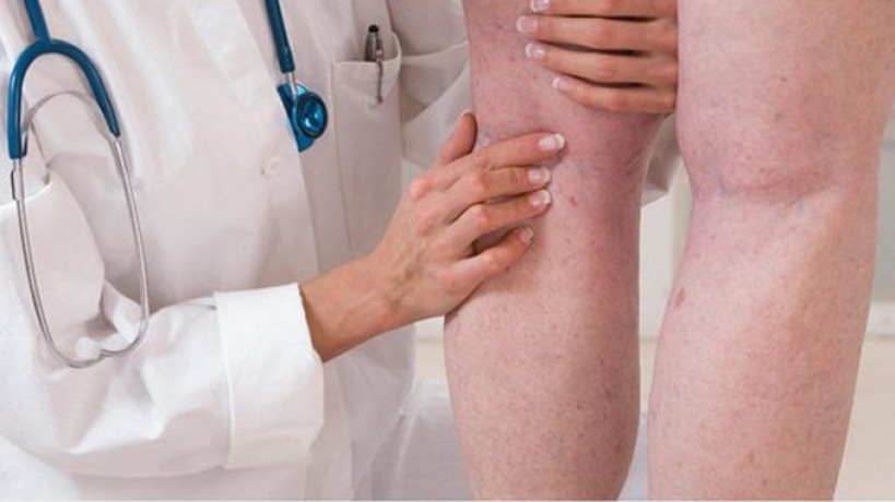 Angiologia e Cirurgia vascular